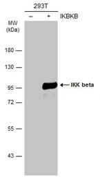 Anti-IKK beta antibody used in Western Blot (WB). GTX110598