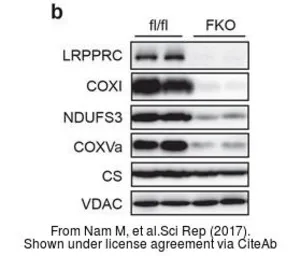 Anti-Citrate synthase antibody [N2C3] used in Western Blot (WB). GTX110624