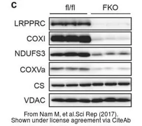 Anti-Citrate synthase antibody [N2C3] used in Western Blot (WB). GTX110624