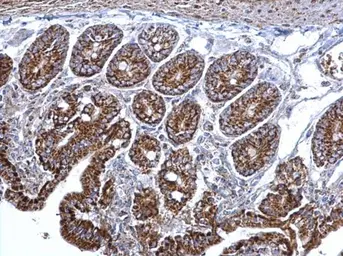 Anti-Citrate synthase antibody [N2C3] used in IHC (Paraffin sections) (IHC-P). GTX110624