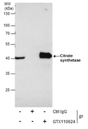 Anti-Citrate synthase antibody [N2C3] used in Immunoprecipitation (IP). GTX110624