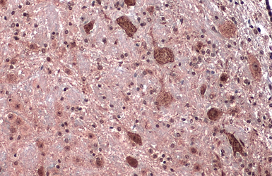 Anti-Citrate synthase antibody [N2C3] used in IHC (Paraffin sections) (IHC-P). GTX110624