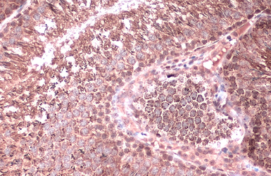 Anti-Citrate synthase antibody [N2C3] used in IHC (Paraffin sections) (IHC-P). GTX110624