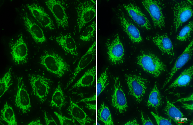 Anti-Citrate synthase antibody [N2C3] used in Immunocytochemistry/ Immunofluorescence (ICC/IF). GTX110624