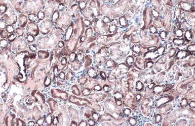 Anti-Citrate synthase antibody [N2C3] used in IHC (Paraffin sections) (IHC-P). GTX110624