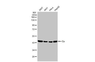 Anti-Citrate synthase antibody [N2C3] used in Western Blot (WB). GTX110624