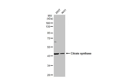 Anti-Citrate synthase antibody [N2C3] used in Western Blot (WB). GTX110624