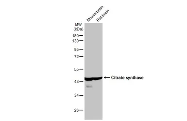 Anti-Citrate synthase antibody [N2C3] used in Western Blot (WB). GTX110624