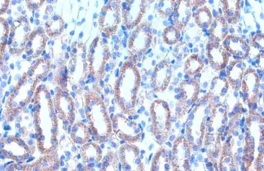 Anti-Citrate synthase antibody [N2C3] used in IHC (Paraffin sections) (IHC-P). GTX110624