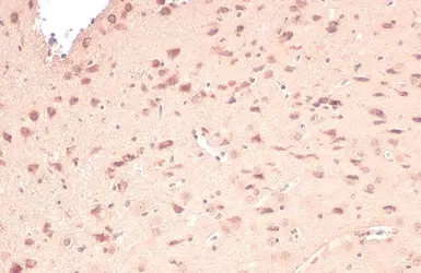 Anti-Citrate synthase antibody [N2C3] used in IHC (Paraffin sections) (IHC-P). GTX110624