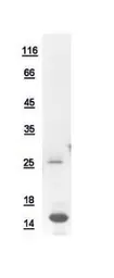 Human Peptide YY protein, His tag. GTX110638-pro