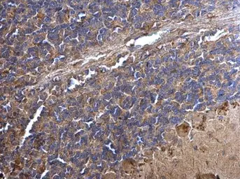 Anti-PPT1 antibody [N1C3] used in IHC (Paraffin sections) (IHC-P). GTX110677