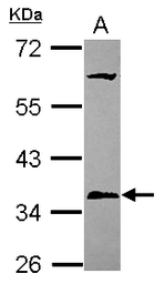 Anti-PPT1 antibody [N1C3] used in Western Blot (WB). GTX110677