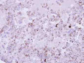 Anti-PPT1 antibody [N1C3] used in IHC (Paraffin sections) (IHC-P). GTX110677