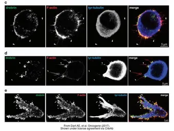 Anti-Drebrin antibody used in Immunocytochemistry/ Immunofluorescence (ICC/IF). GTX11068