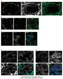 Anti-Drebrin antibody used in Immunocytochemistry/ Immunofluorescence (ICC/IF). GTX11068