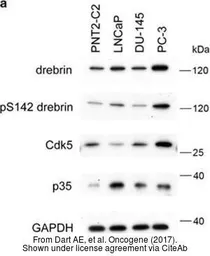 Anti-Drebrin antibody used in Western Blot (WB). GTX11068