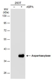 Anti-Aspartoacylase antibody used in Western Blot (WB). GTX110699