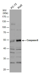 Anti-Caspase 8 antibody used in Western Blot (WB). GTX110723