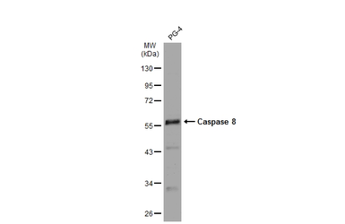 Anti-Caspase 8 antibody used in Western Blot (WB). GTX110723