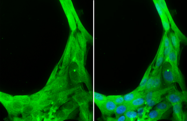 Anti-Caspase 8 antibody used in Immunocytochemistry/ Immunofluorescence (ICC/IF). GTX110723