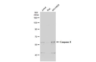 Anti-Caspase 8 antibody used in Western Blot (WB). GTX110723