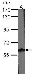 Anti-CARD9 antibody [N1N3] used in Western Blot (WB). GTX110789