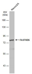 Anti-FASTKD5 antibody [C2C3], C-term used in Western Blot (WB). GTX110844