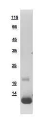 Human TRIAP1 protein, His tag. GTX110986-pro