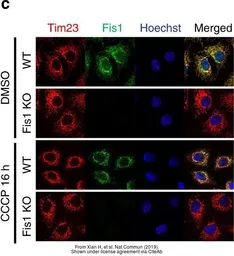 Anti-FIS1 antibody used in Immunocytochemistry/ Immunofluorescence (ICC/IF). GTX111010