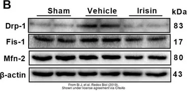 Anti-FIS1 antibody used in Western Blot (WB). GTX111010