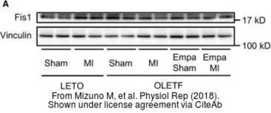 Anti-FIS1 antibody used in Western Blot (WB). GTX111010