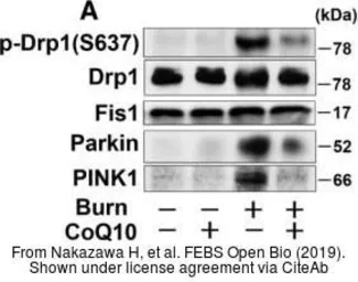 Anti-FIS1 antibody used in Western Blot (WB). GTX111010