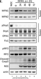 Anti-FIS1 antibody used in Western Blot (WB). GTX111010