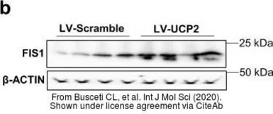 Anti-FIS1 antibody used in Western Blot (WB). GTX111010