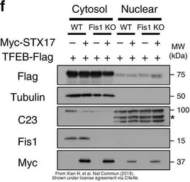 Anti-FIS1 antibody used in Western Blot (WB). GTX111010