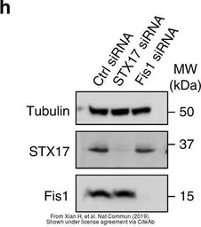 Anti-FIS1 antibody used in Western Blot (WB). GTX111010