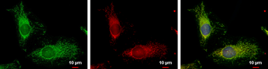 Anti-FIS1 antibody used in Immunocytochemistry/ Immunofluorescence (ICC/IF). GTX111010