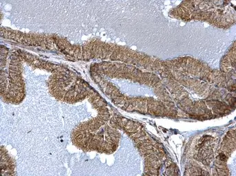 Anti-FIS1 antibody used in IHC (Paraffin sections) (IHC-P). GTX111010