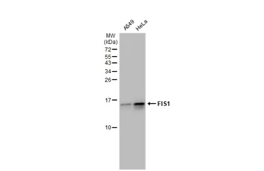 Anti-FIS1 antibody used in Western Blot (WB). GTX111010