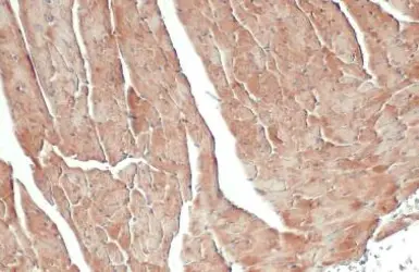 Anti-FIS1 antibody used in IHC (Paraffin sections) (IHC-P). GTX111010