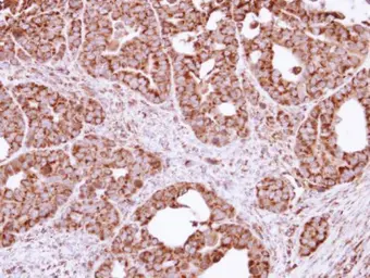 Anti-FIS1 antibody used in IHC (Paraffin sections) (IHC-P). GTX111010