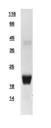 Human EIF5A protein, His tag. GTX111013-pro