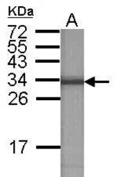 Anti-ATP6V1E2 antibody [N1C3] used in Western Blot (WB). GTX111015