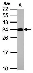 Anti-ATP6V1E2 antibody [N1C3] used in Western Blot (WB). GTX111015