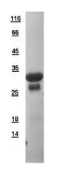 Human V-ATPase D protein, His tag. GTX111025-pro