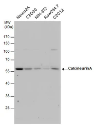 Anti-Calcineurin A antibody used in Western Blot (WB). GTX111039