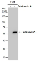 Anti-Calcineurin A antibody used in Western Blot (WB). GTX111039