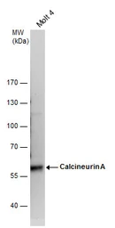 Anti-Calcineurin A antibody used in Western Blot (WB). GTX111039