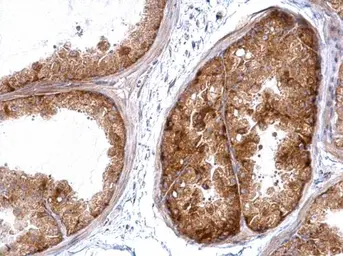 Anti-HSC70 antibody [N2C1], Internal used in IHC (Paraffin sections) (IHC-P). GTX111069